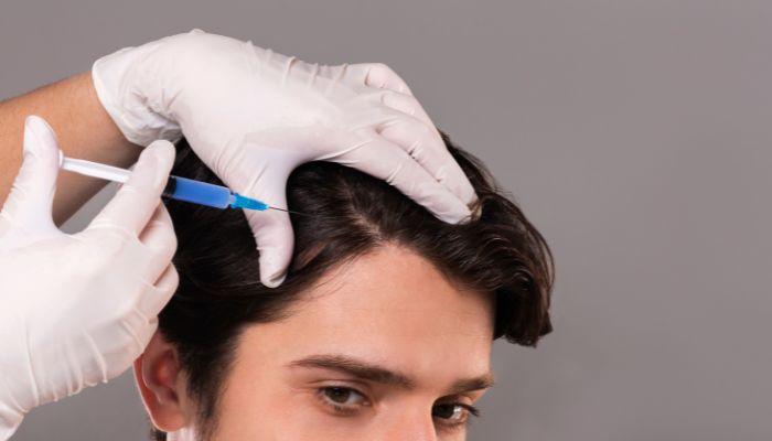 Mesotherapy: The Science-Backed Solution for Thicker, Fuller Hair