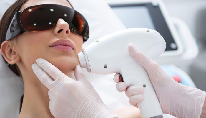 Rosacea Laser Therapy and Skincare Practices